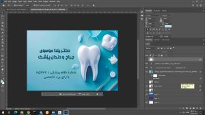 طرح کارت ویزیت لایه باز دندان پزشکی